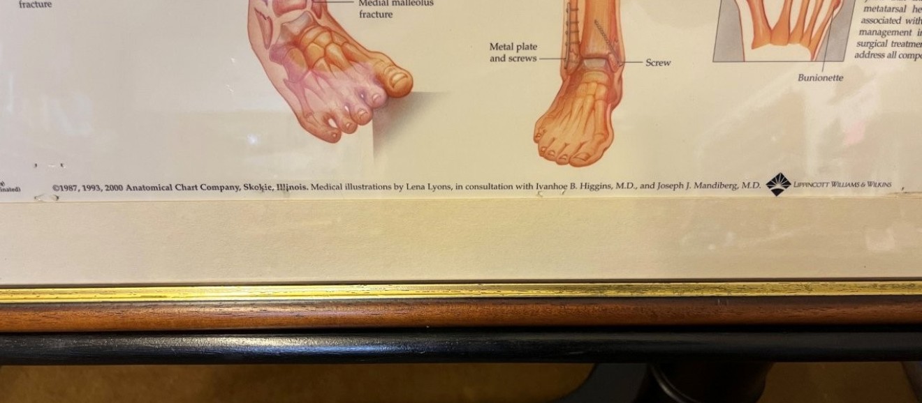 Vintage Framed Foot and Ankle Medical Anatomy Chart
