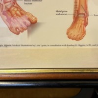 Vintage Framed Foot and Ankle Medical Anatomy Chart